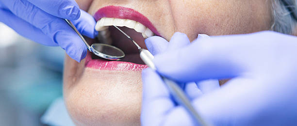 Best Emergency Tooth Extraction in Bellville, TX